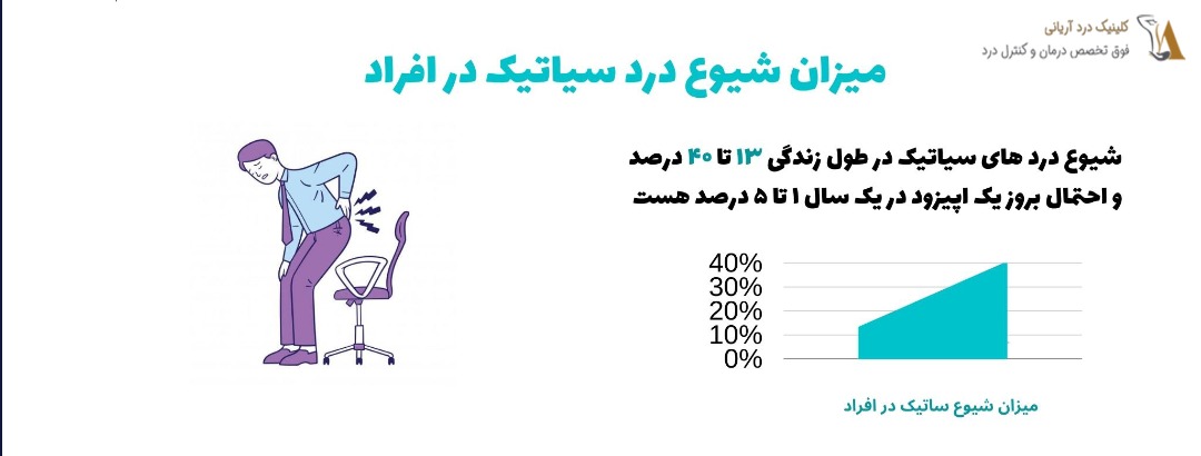 سن شروع درد سیاتیک