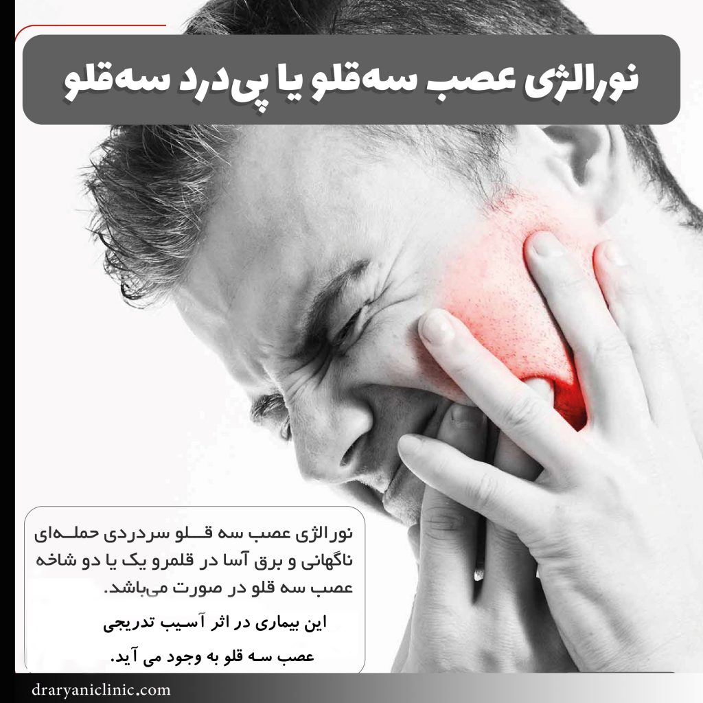 درمان درد عصب سه قلو