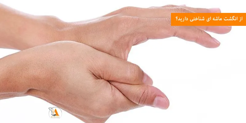 از انگشت ماشه ای شناختی دارید؟