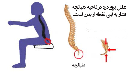 علل-درد-دنبالچه