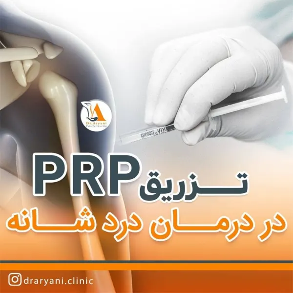 تزریق-PRP-کاربردها