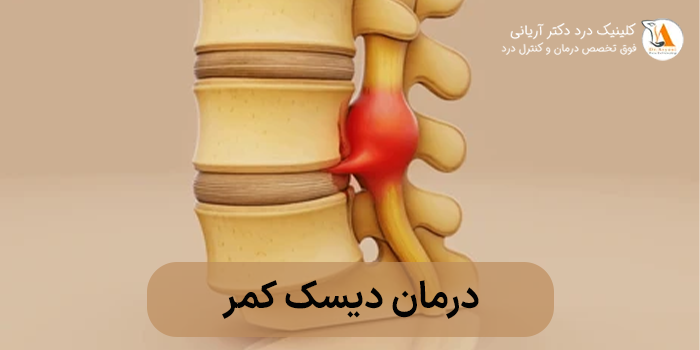 دیسک کمر چیست ؟
