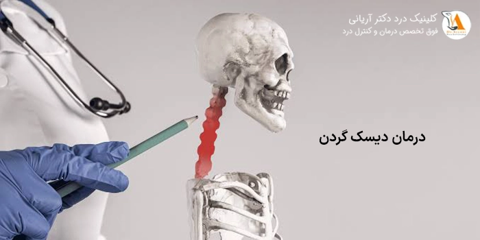 درمان دیسک گردن