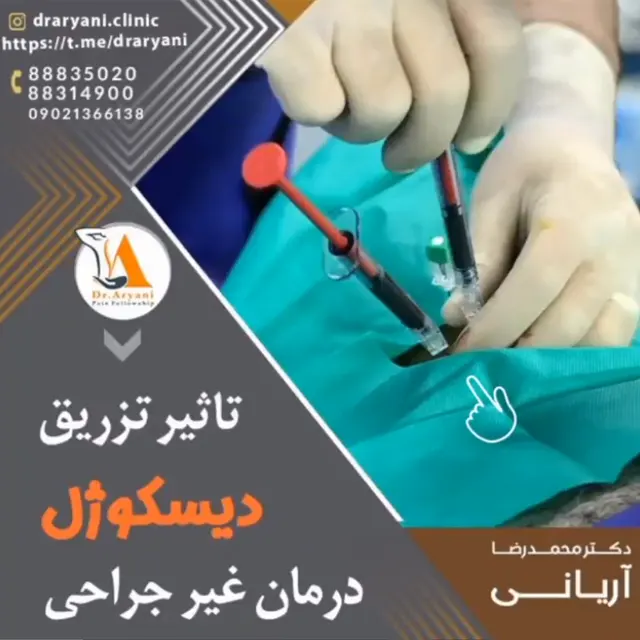 تاثیر تزریق دیسکوژل