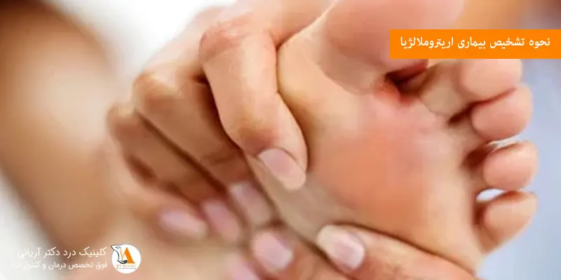 نحوه تشخیص بیماری اریتروملالژیا