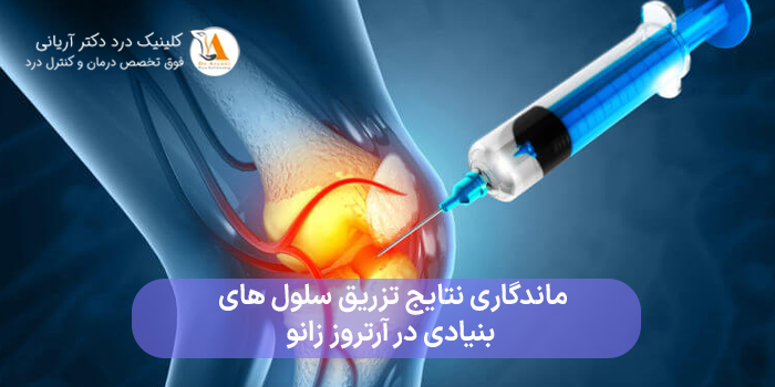 ماندگاری نتایج تزریق سلول های بنیادی در آرتروز زانو