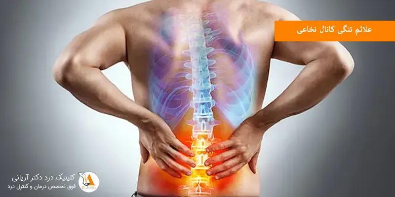 علائم تنگی کانال نخاعی