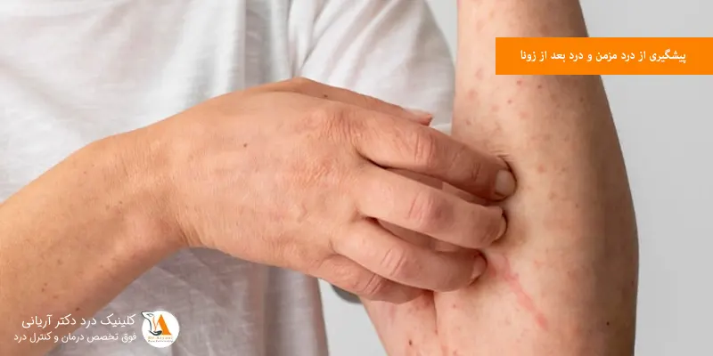 پیشگیری از درد مزمن و درد بعد از زونا