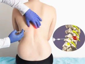 اوزون تراپی دیسک کمر